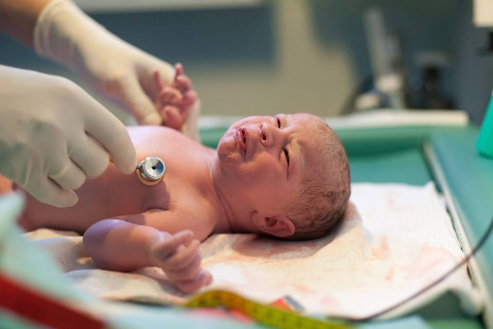 Атрезия ануса у новорожденных