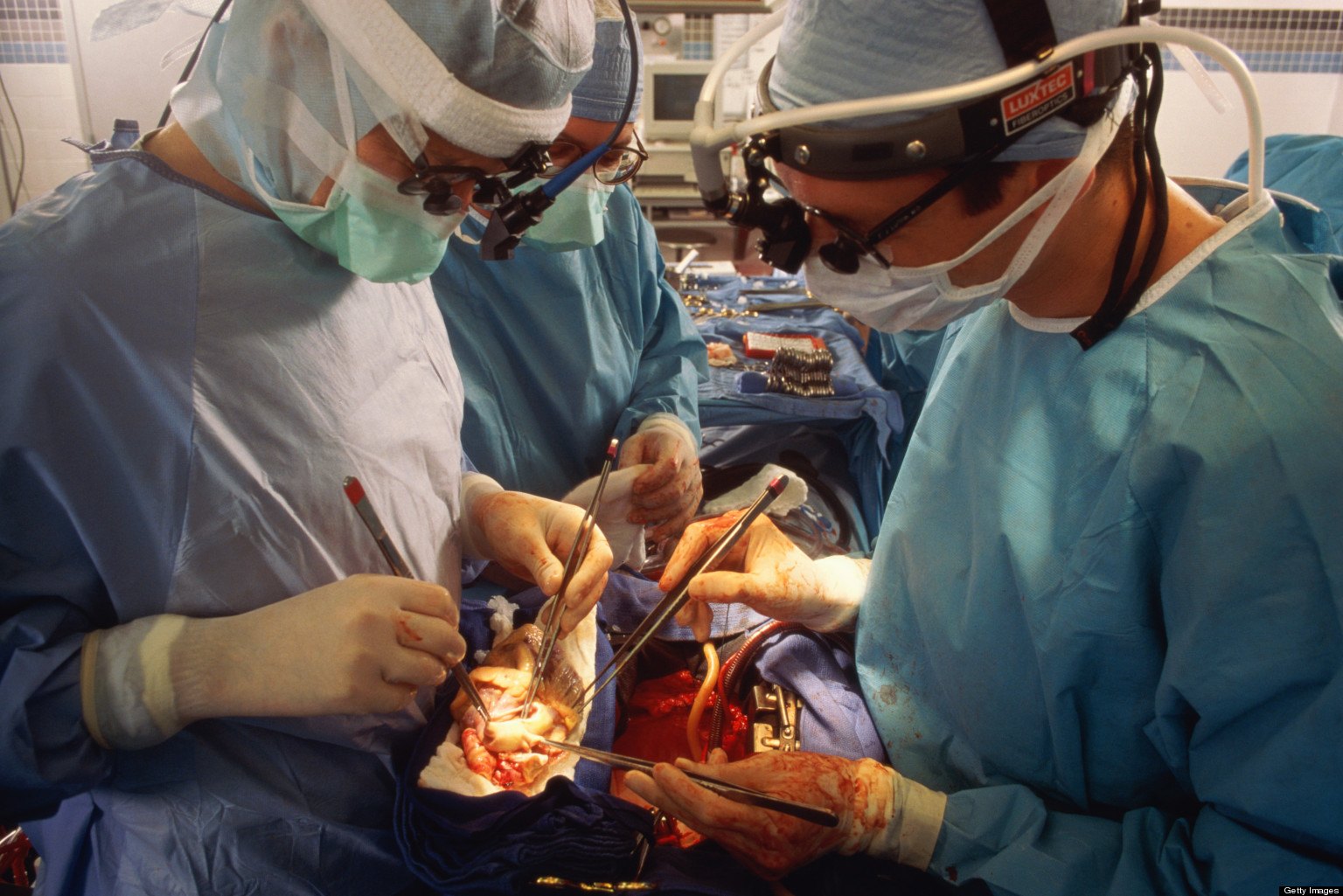 Трансплантация сердца в Израиле